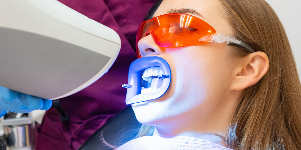 Teeth Whitening Pickering