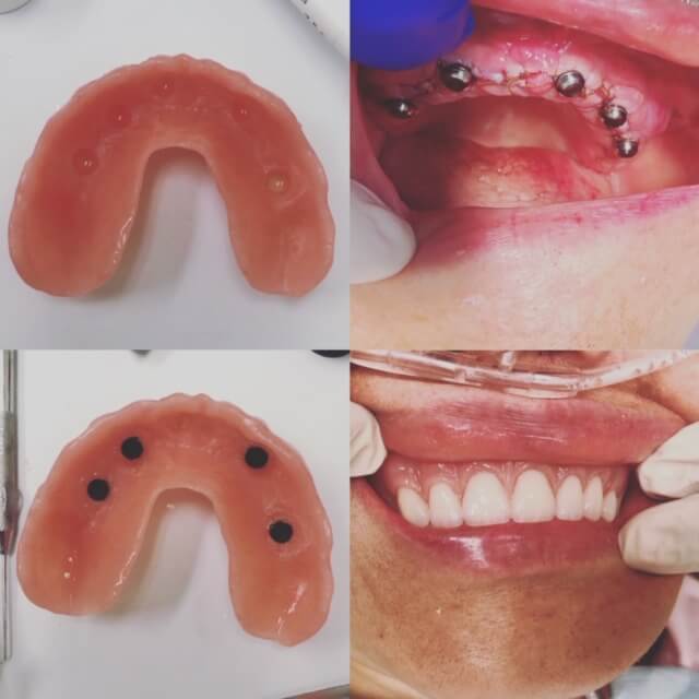 Denture Design Clinic Office Image 8